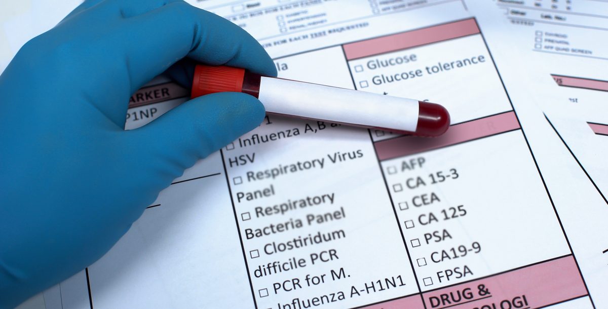 Understand Your Lab Results