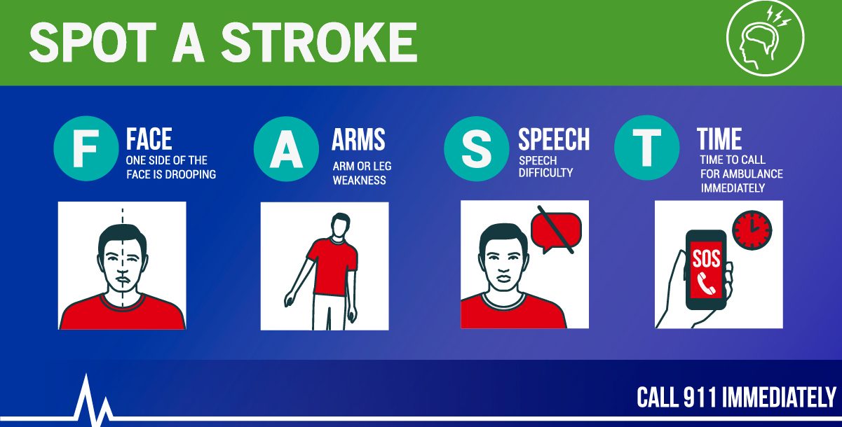 Is Mild Stroke Dangerous