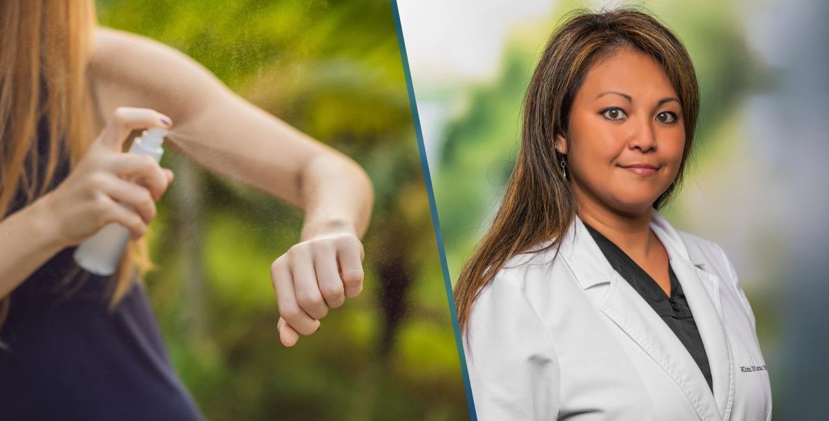bon secours greenville, how to treat bug bites