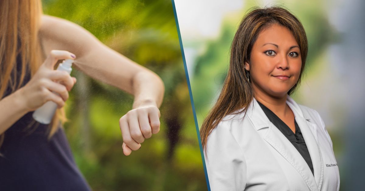 bon secours greenville, how to treat bug bites